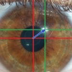 Pupil dilation measurement